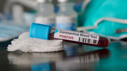 Why NBA players can get coronavirus tests but regular Americans are struggling to