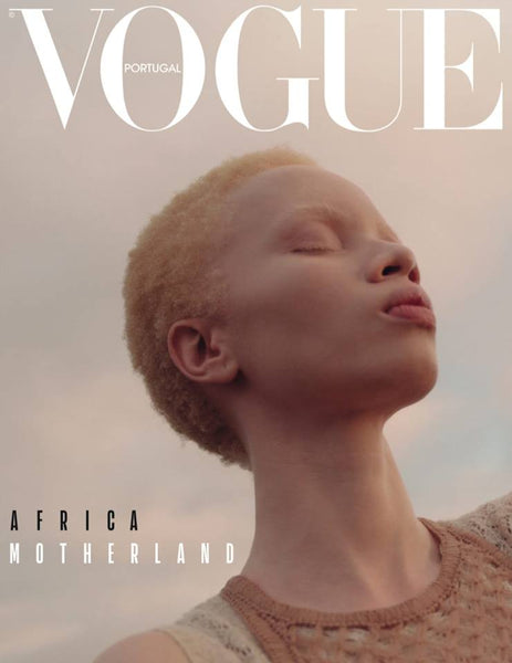 Thando Hopa Makes History as the First Woman with Albinism on a Vogue Cover